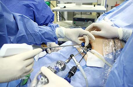מינץ בניתוח להסרת כיס המרה דרך הטבור. "לא רוצה שייתנו לי הרגשה שאני צריך לטפל טוב יותר במי ששילם" מינץ בניתוח להסרת כיס המרה דרך הטבור. "לא רוצה שייתנו לי הרגשה שאני צריך לטפל טוב יותר במי ששילם"
