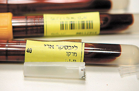 מעט מהדם שהקזתי. בהתחלה עוד קיבלתי סחרחורת מעט מהדם שהקזתי. בהתחלה עוד קיבלתי סחרחורת