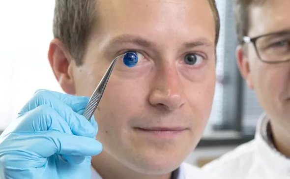 A technician holds up a 3D printed cornea. Photo: Newcastle University A technician holds up a 3D printed cornea. Photo: Newcastle University