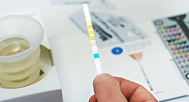   Healthy.io urine test kit. Photo: PR 