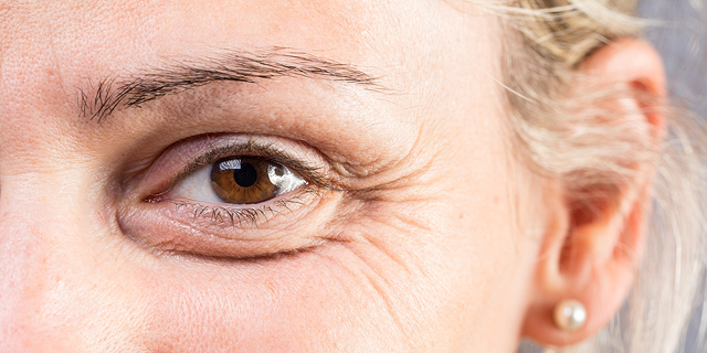 Botox Alternative Startup SofWave Raises $8.4 Million