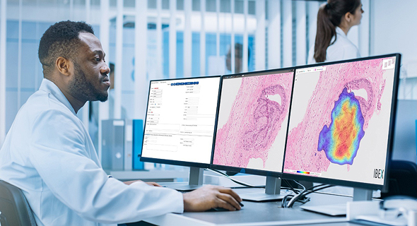 Medical imaging in operation. Photo Ibex Medical Analytics Medical imaging in operation. Photo Ibex Medical Analytics