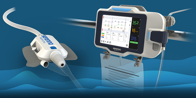 Elcam Medical invests $1.5 million in Serenno Medical for kidney monitoring device