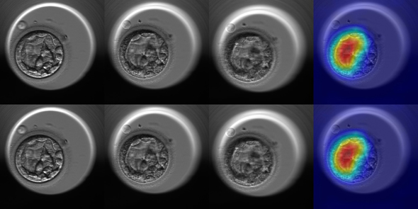 Some of the analyzed embryos in the test showincasing the results
