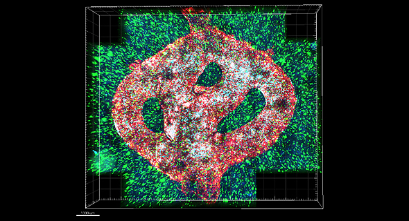 A microscopic image of the 3D-bioprinted glioblastoma model. Photo: Tel Aviv University