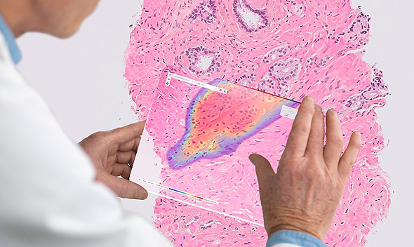 Ibex Medical Analytics' platform allows pathologists the ease of AI tools to make early cancer diagnoses. Photo: Ibex Medical Analytics