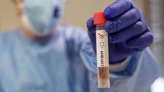 בדיקה קורונה וירוס Roche, צילום: formic.net 