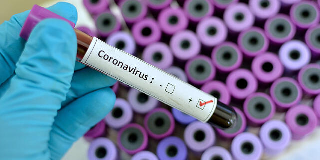 בדיקה וירוס נגיף קורונה תרופה