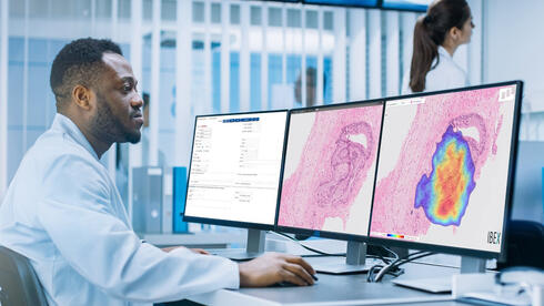 Ibex Medical Analytics Ibex Medical Analytics